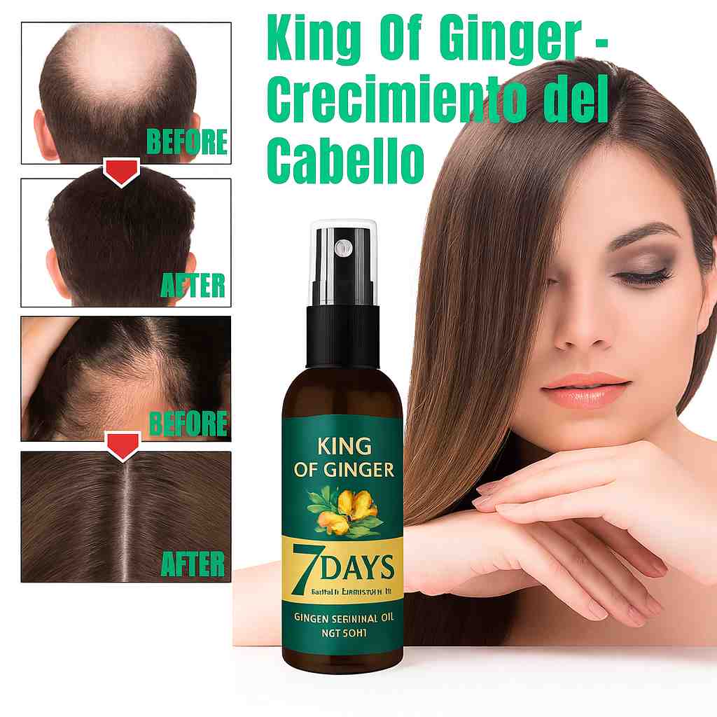 King of Ginger: Fórmula Natural de Jengibre – Para un Cabello Más Denso y Saludable 🌿