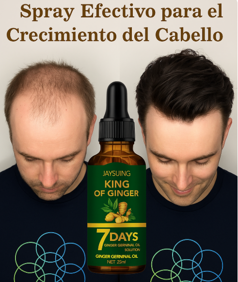 King of Ginger: Fórmula Natural de Jengibre – Para un Cabello Más Denso y Saludable 🌿